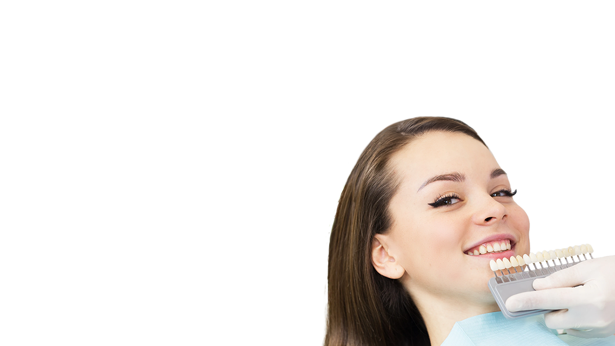 faccette dentali